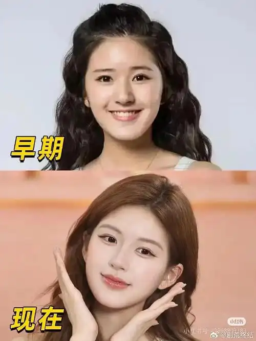 赵露思早期与现在的对比图,大家觉得这个变化明显吗?