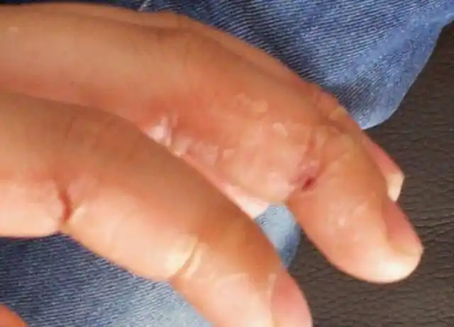 吃手的孩子"聪明"?除了不卫生,还有两大危害家长必须知晓