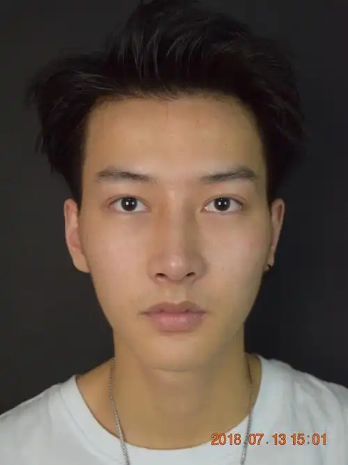 鼻子轻微向右歪斜,不认真看不出来,但小哥哥本人很在意,山根鼻梁略矮
