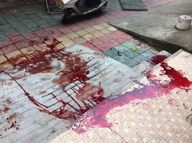 可地上这么大一滩血可不是鸡鸭牛羊的血,这可是人身上流出来的血