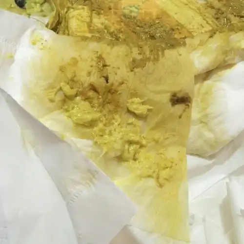 宝宝拉稀,疑似绦虫(有图,慎入)