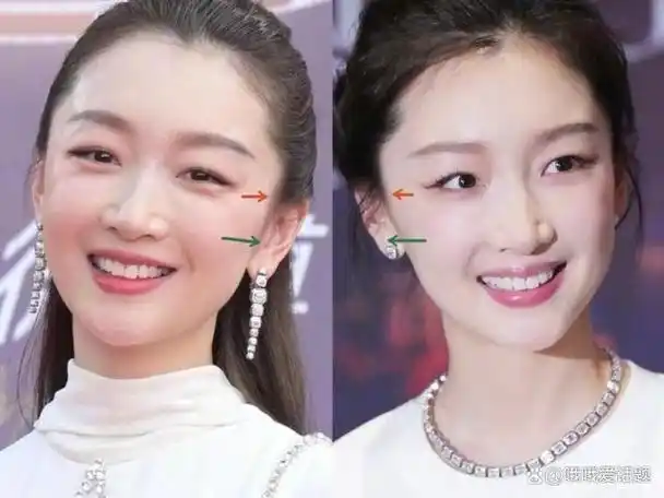 从丑小鸭到白天鹅:周冬雨的美丽蜕变