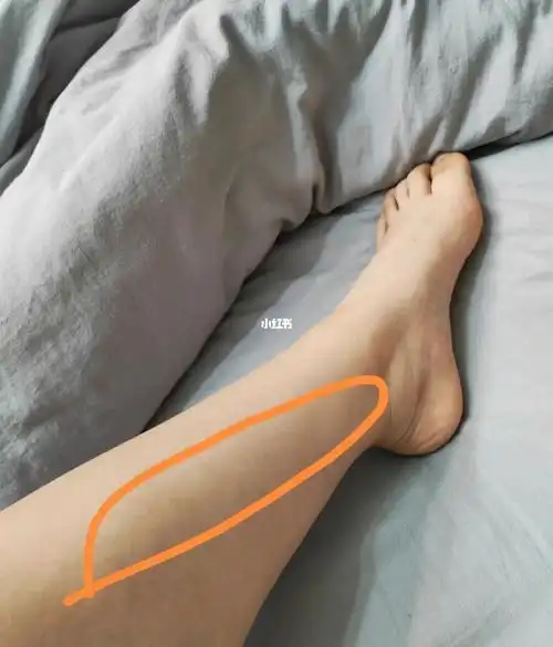 跳绳小腿前侧就疼