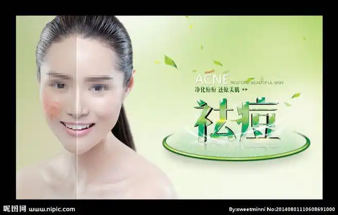 祛痘广告