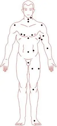 6,男性朋友如果痣长在阴囊上,无论是在哪一侧,都代表此痣能给你富贵