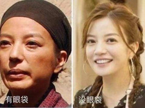 郭京飞割完眼袋后秒变型男!黑西装造型太有范,对比早前判若两人