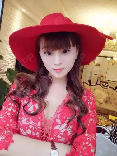 自体脂肪隆胸术后31天_形体填充术后31天_隆胸术后31天_自体脂肪术后