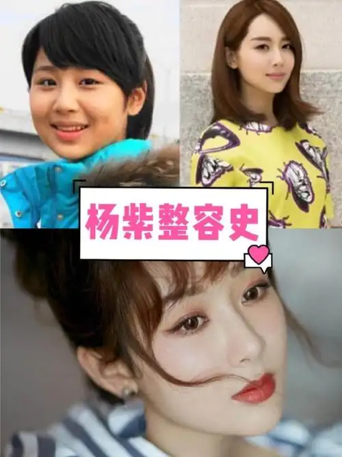 也有网友去深扒杨紫旧照出来,整容前后对比照曝光网友直呼 差距太大了