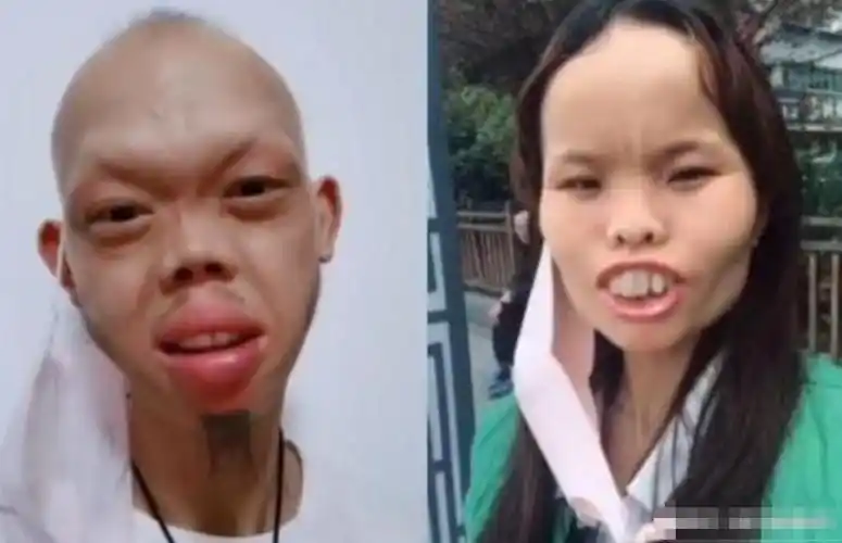 江西女子"一丑成名",靠奇特长相圈粉百万,自信程度不输凤姐