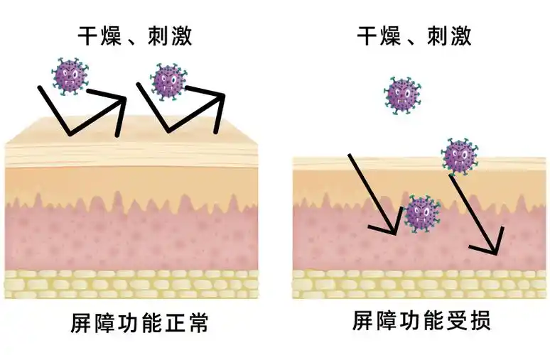 皮肤_水分_流失