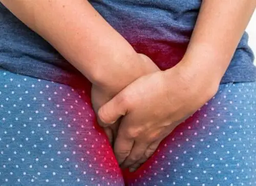 例如滴虫性阴道炎,霉菌性阴道炎,衣原体,支原体,淋病等感染引起的阴道