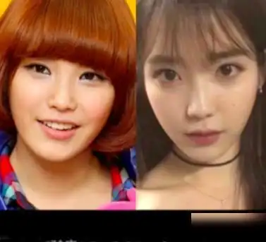 疑似iu整容前照片曝光看清以前模样后能把医生电话给我吗