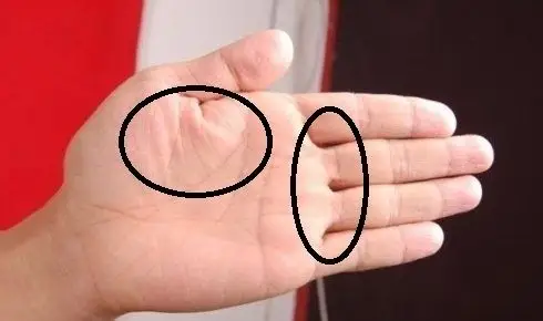 通过手诊,怎么看出肠胃不好