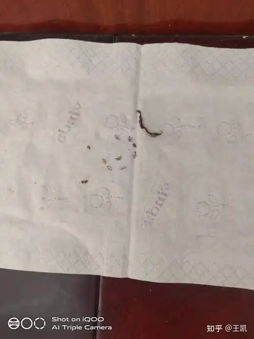 今天下午取出一个钉子,以为还剩一个,于是努力想把它取出,结果发现