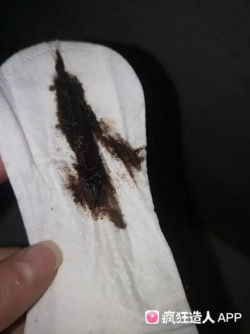 多囊吃鹿胎膏流黑色的血,不知道是什么血,能帮我看看么,有同样的经理