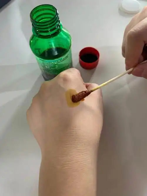 用碘伏祛除扁平疣几乎不可能6060