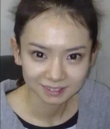 戚薇整容前照片高清,戚薇10年前旧照被疯传,素颜下的五官,确定不是