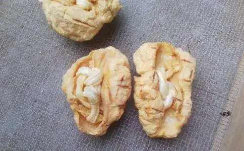 分娩完后,胎盘都去哪里了?这四个去向,唯独最后一个宝妈难以接受