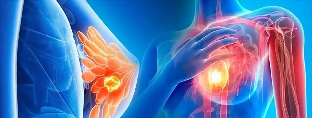 姚贝娜是乳腺癌早期,经过化疗后已经痊愈,为何人还是没了?