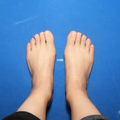 找大脚骨医生没走坑2