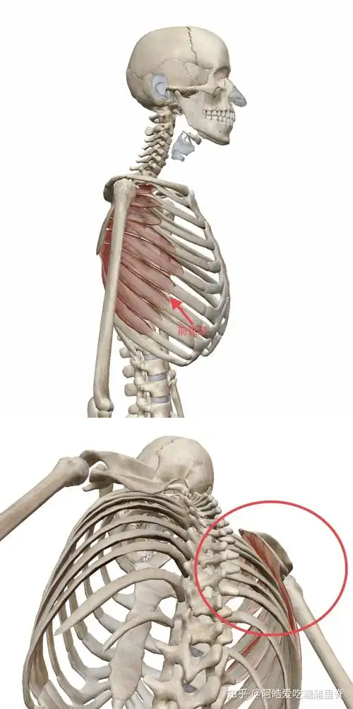 科学解读:畸形审美下的"蝴蝶背",不是性感,而是疼痛的元凶 5 小时前