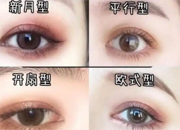 做双眼皮的形状有多少种