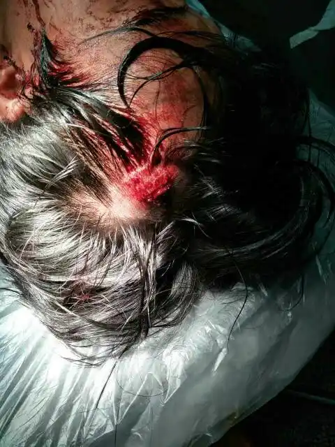 我被十几个人打了,头被打破住院了,打我的人跑了,我报警半个小时之后