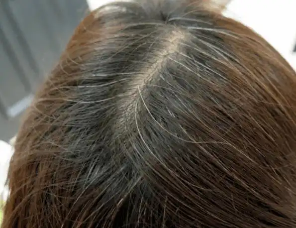 白发越长越多原来是这里出了毛病坚持一招养一头乌黑墨发