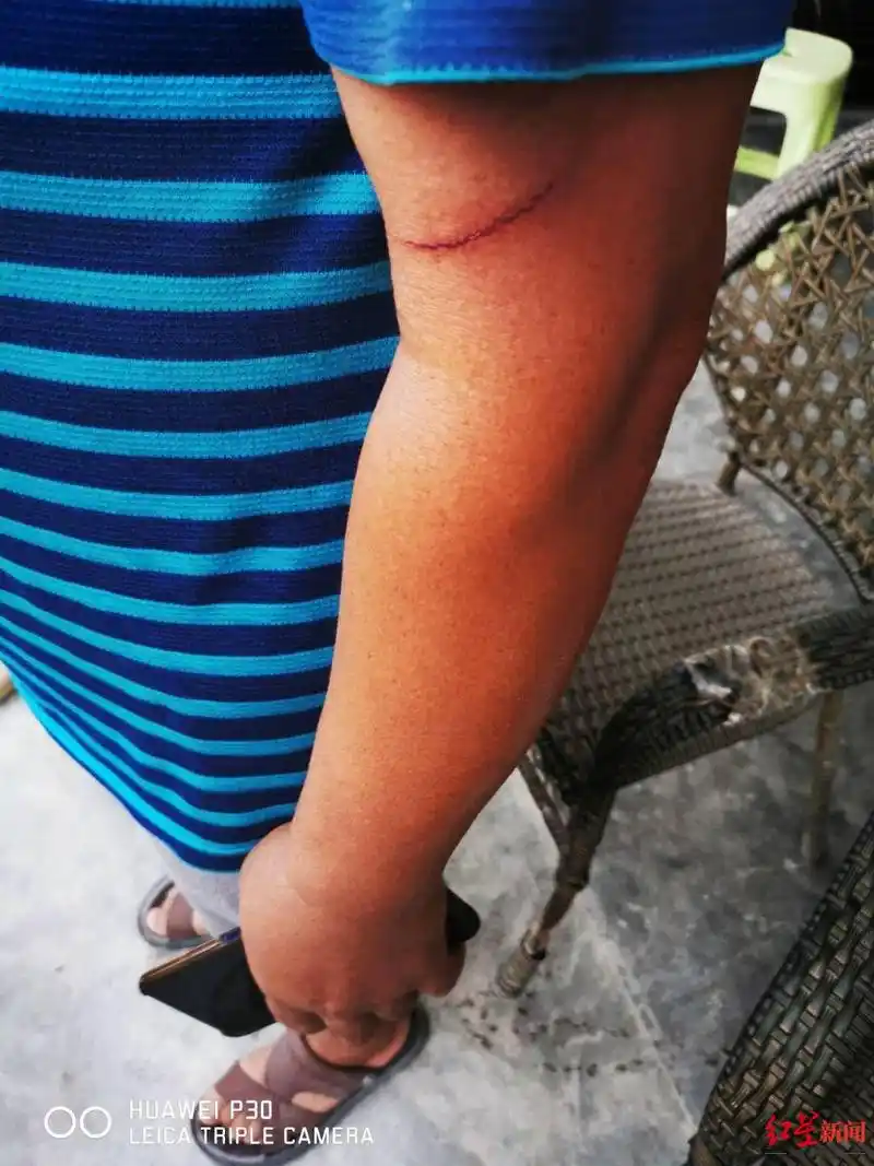 因一句抖音留言感到侮辱50岁大姐砍伤邻居已认错警方介入