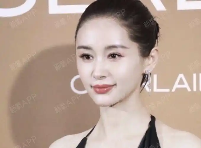 恰到好处的脂肪填充,王子文做的太绝了6015求求你们快_圈子-新氧