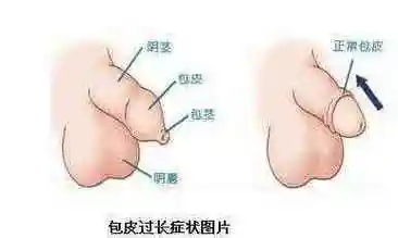 蓝天男科  服务全国   本文已为217位患者解决了问题