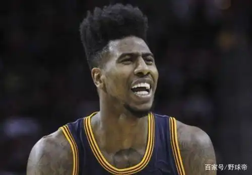 香波特 香波特的扫把头发型,当初也是"惊人的存在"!