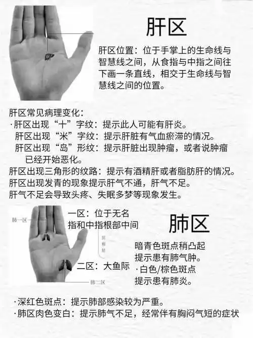 手掌中出现的岛形纹和米字纹,都有什么意义你知道吗?