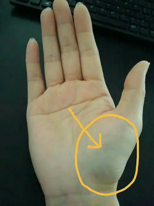 我的手掌,发青,说明宫寒,有血块