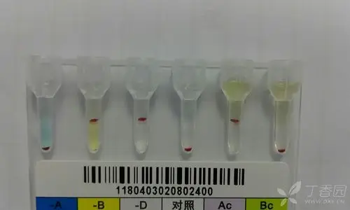 日常工作凝胶微柱法测血型出现以下结果,请问怎样判定,直接判为b型吗?