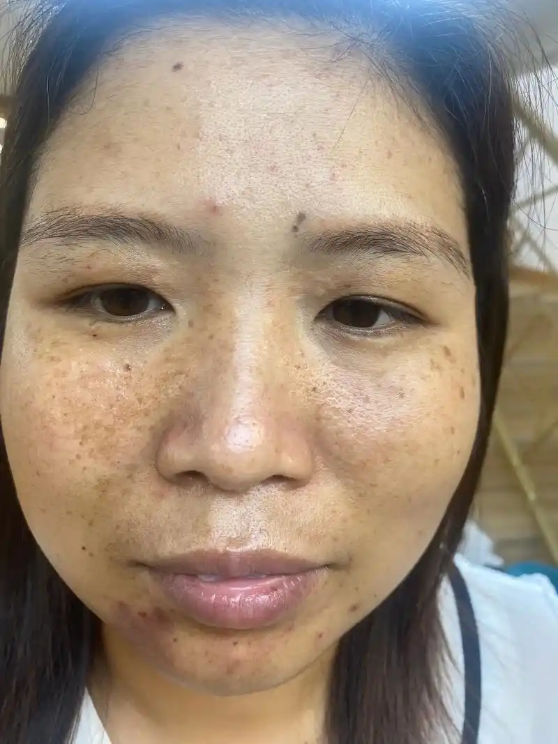 谁又不是天生就这样. 找对真正能够解决你皮肤问题的人 脸就这 - 抖音