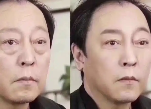 去掉眼袋的倪大红成了校草?本以为太夸张,看完照片后啪啪打脸!