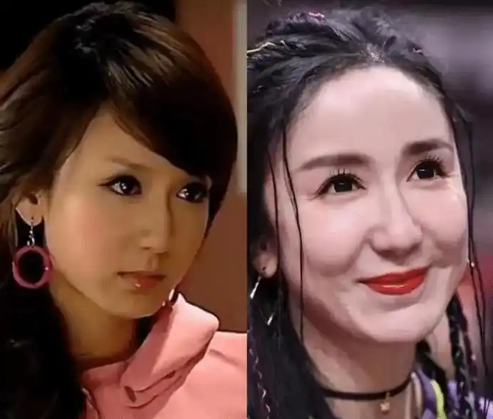 这4位整容失败的女星,张檬自断前程,刘晓庆僵脸演少女,太可惜