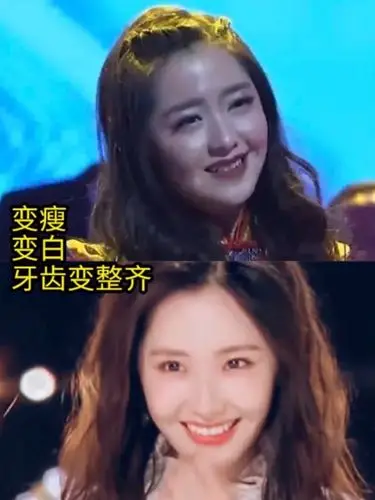 96蜜糖女孩王艺瑾的辨识度还是很高的,在创造营里特别_圈子-新氧