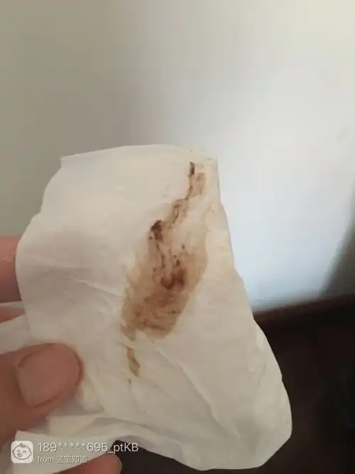 有褐色分泌物是什么原因(内裤上面有褐色分泌物是什么原因)