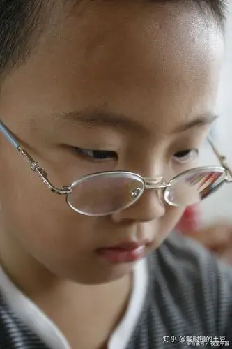 孩子近视后不戴眼镜会有什么后果