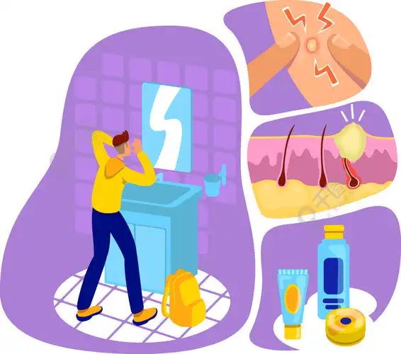 痤疮平面概念矢量图皮肤科问题美容护肤不健康的脸青少年粉刺2d卡通