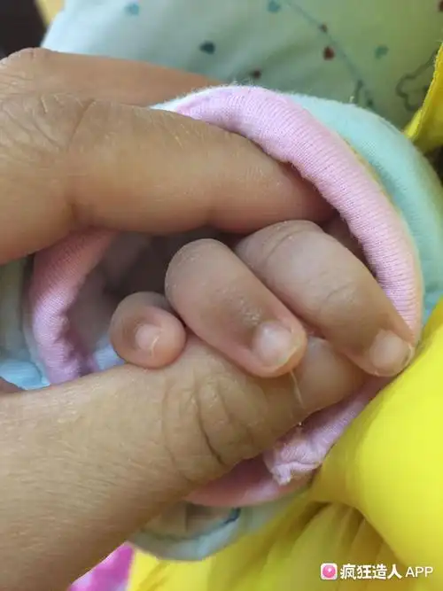 宝宝指甲尖发黑