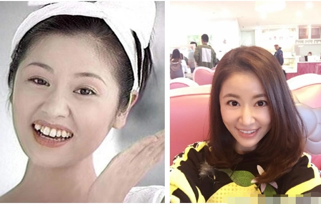 娱乐圈4位女星矫正牙齿前后对比照,你更喜欢哪一个?