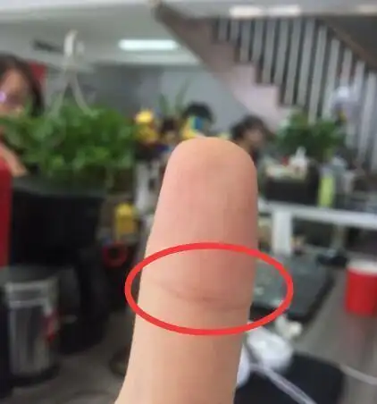 每个人的手相都不一样,但是手上有一种纹路从古代开始就代表着有这个