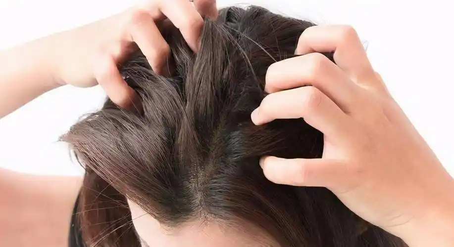 头皮很痒是怎么回事头皮巨痒什么情况