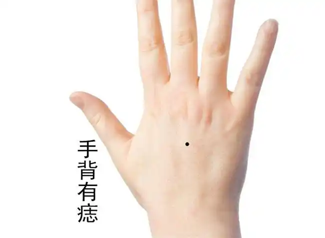 女人手背有个富痣图相 生近官近利