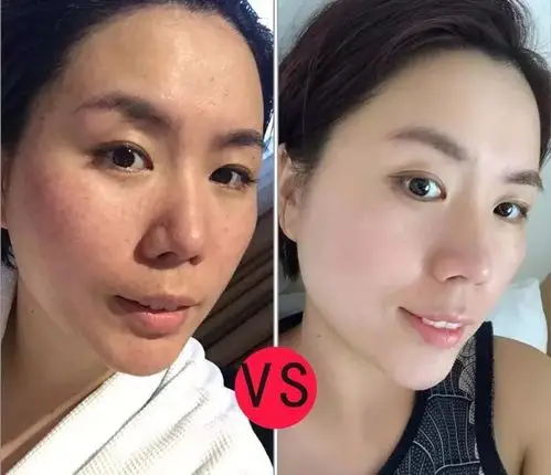 多数女人不知道月经不调皮肤差容易胖的根本原因是