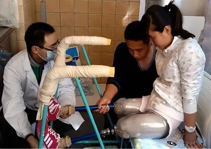 回顾为救学生,她的双腿被截肢,获捐款1000多万的她,如今怎样了