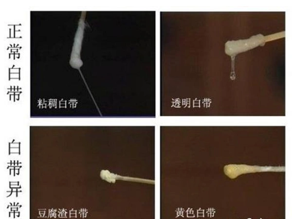 着床成功正常白带图片
